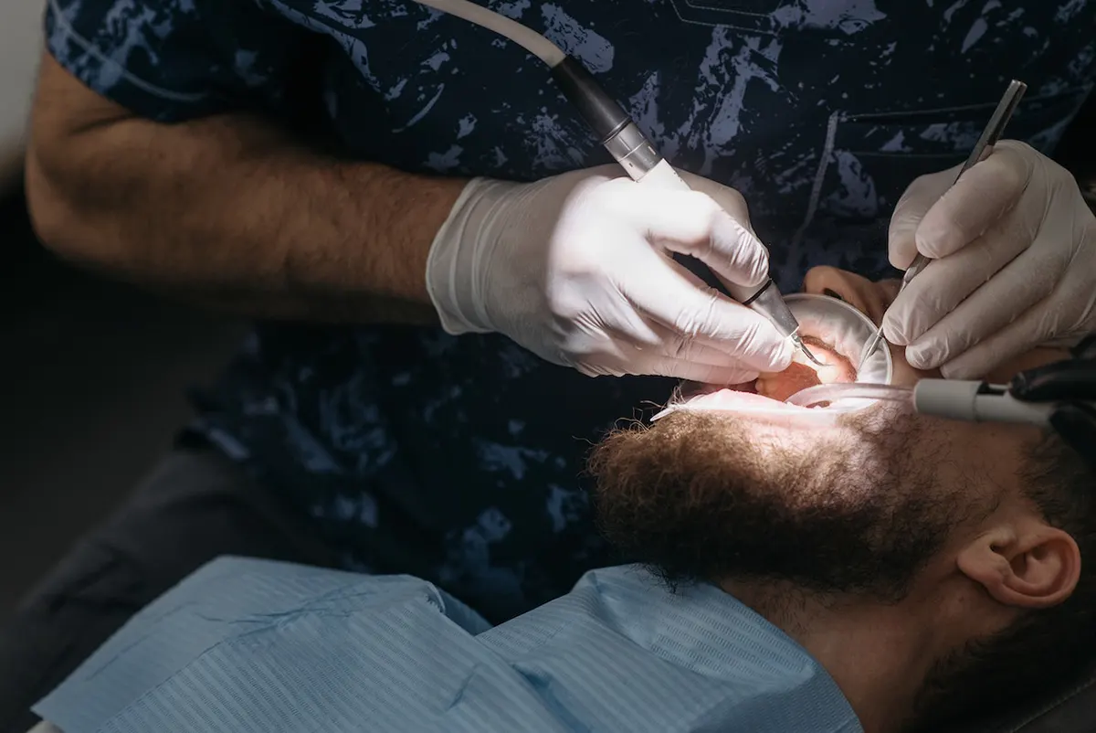 Why do Amish People Get Their Teeth Pulled?