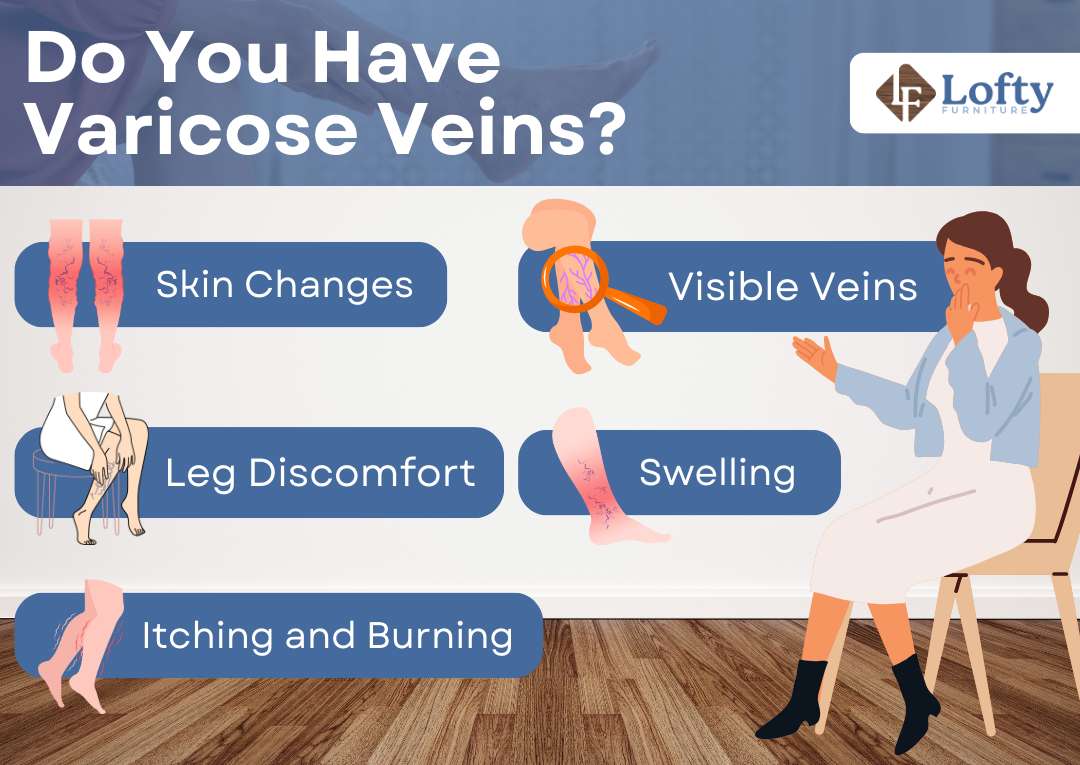 An infographic about having varicose veins.